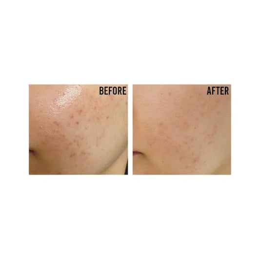 Creme solaire - Sun relief